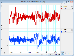 Audio Output
